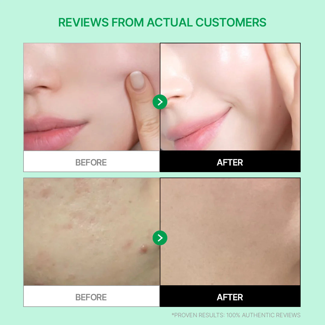 Cicamanu Gel Cream