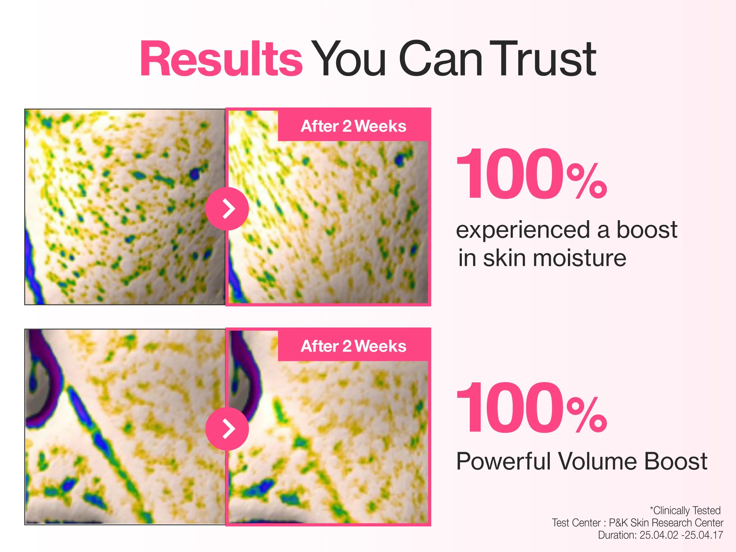 No.2 Rose PDRN Collagen Plumping Sheet Mask